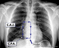 CXR Sweet Spot™ Box Measurements