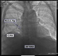 CXR Sweet Spot™ Box Measurements