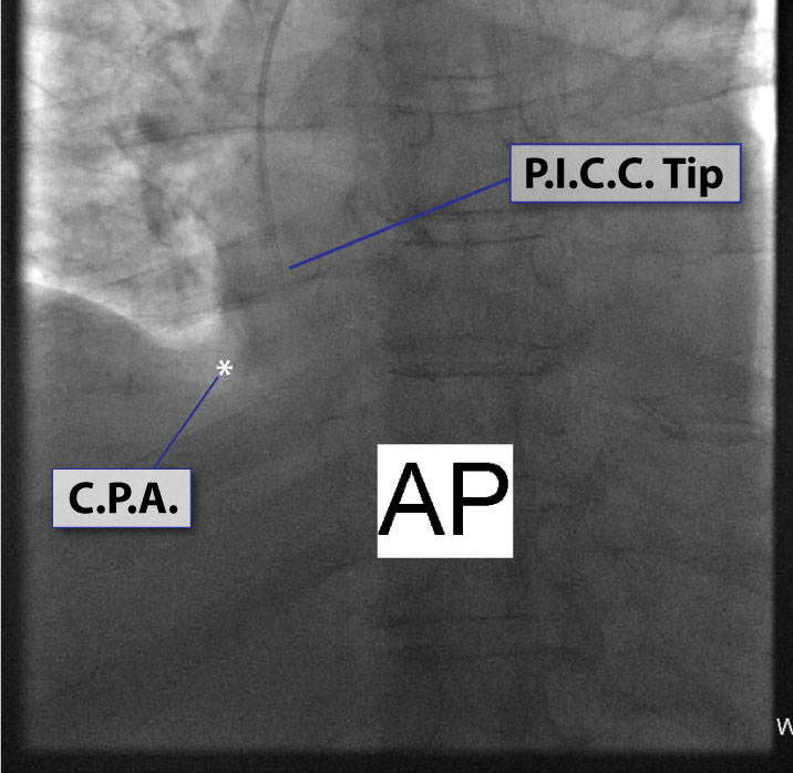 CXR Sweet Spot™ Box Measurements