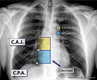 CXR Sweet Spot™ Box Measurements (4cm x 8cm)