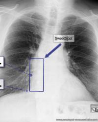 CXR Sweet Spot™ Box Measurements