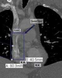 Enhanced coronal CT reconstruction