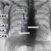 Dual energy CXR. Another variation in Sweet Spot™ dimensions